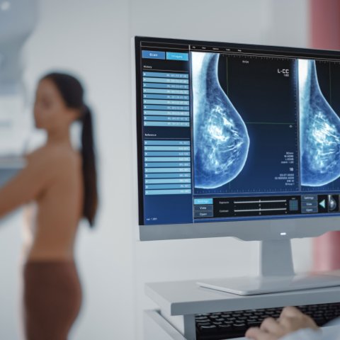 Brustkrebs ist heute in vielen Fällen heilbar – wenn er frühzeitig entdeckt wird.